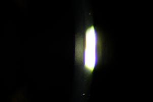 Corneal endothelial cells